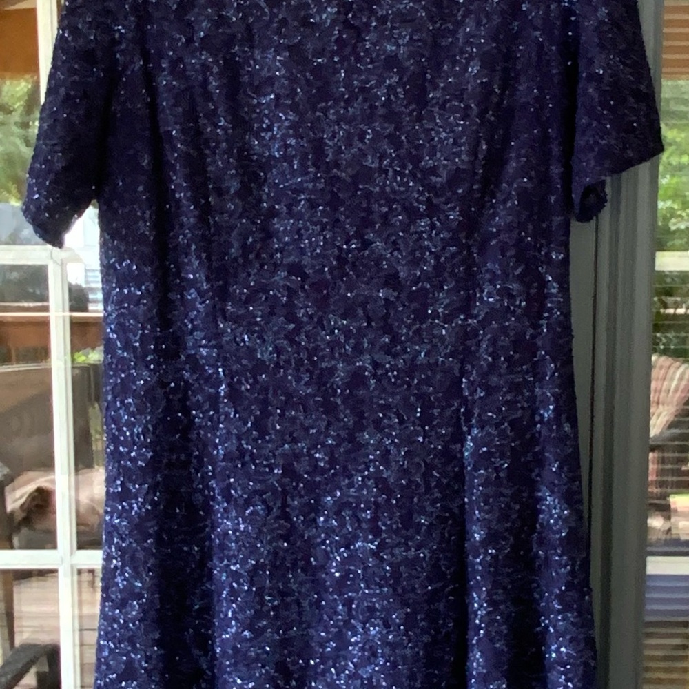 Elegant Blue Lace Dress